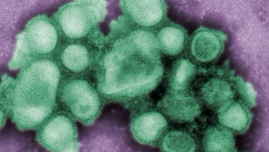 bne IntelliNews - Japan's flu outbreak hits record high amid winter surge